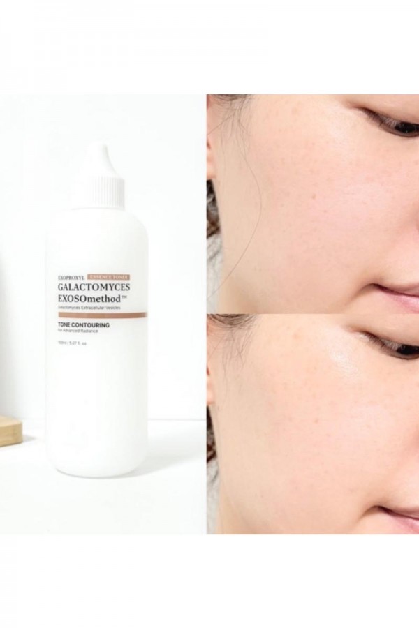 Exoproxyl 半乳糖酵母菌外囊泡精萃水150ML