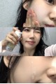 韓國 Infod Plus Xcespi316 微針潔面凝膠100ml