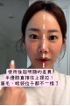 Slosoph Pcl 拉提塗抹式線雕精華